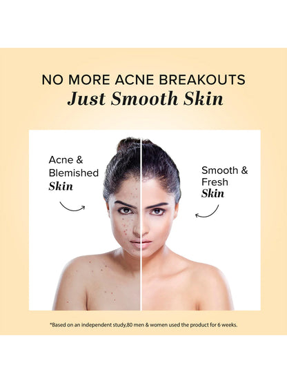 Khadi Natural Acne Pimple Cream (50g)