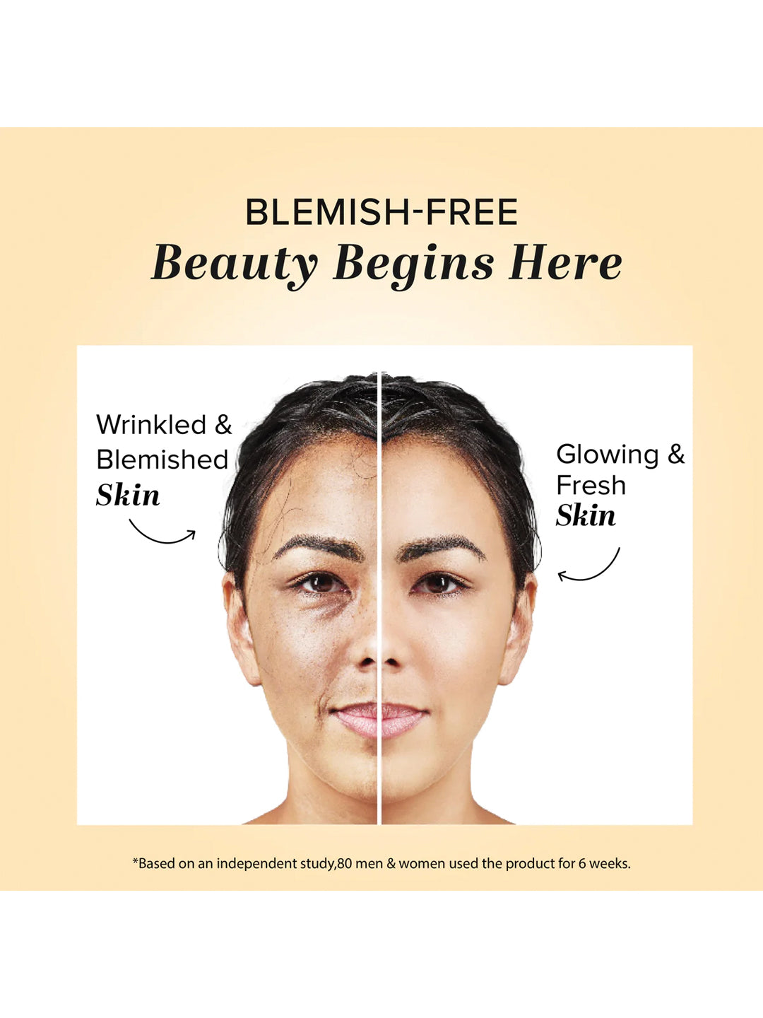 Khadi Natural Anti Blemish Cream (50g)