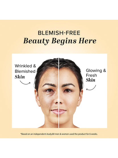 Khadi Natural Anti Blemish Cream (50g)