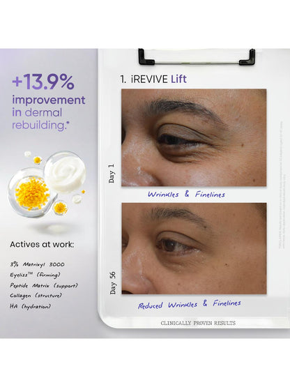 SkinInspired iREVIVE Dual Chamber Under Eye Serum (24 ml)