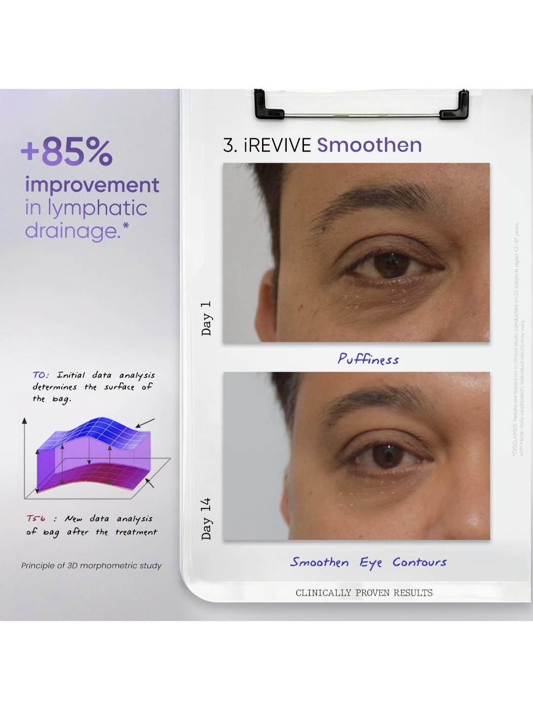 SkinInspired iREVIVE Dual Chamber Under Eye Serum (24 ml)